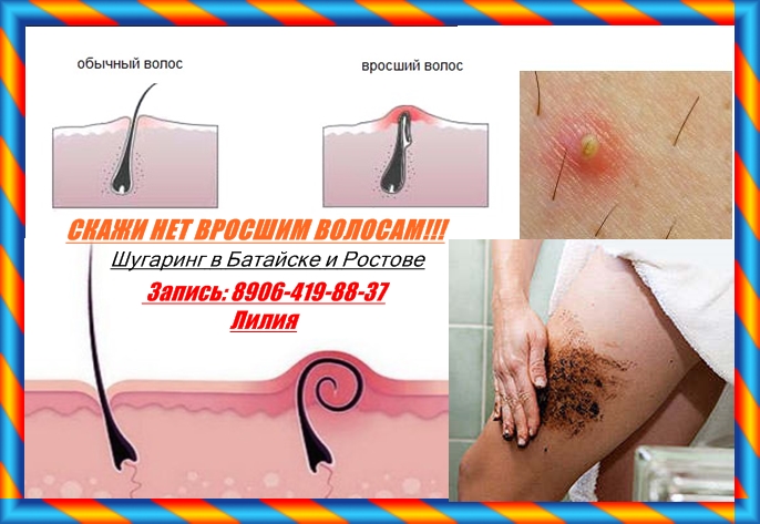 Глубокая эпиляция бикини глубокое в домашних условиях Глубокая эпиляция бикини глубокое в домашних условиях